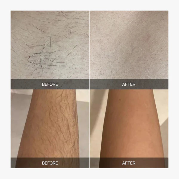 VeloraSmooth™ — Pain-Free Glow That Lasts Weeks Beyond Shaving