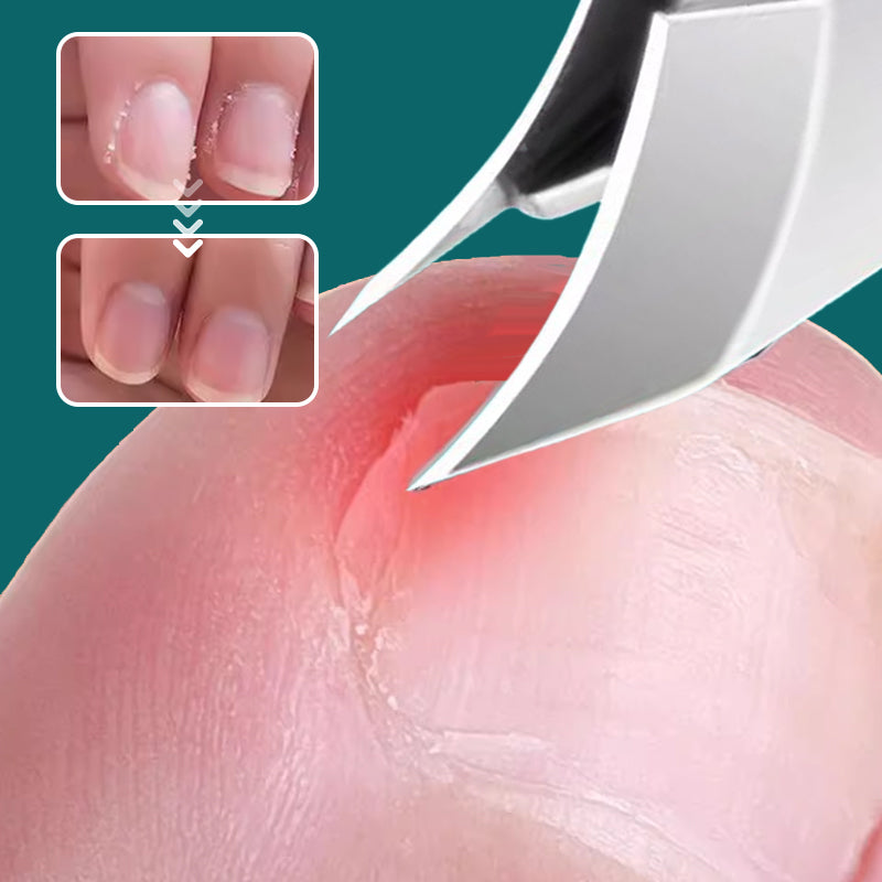 EdgeGrace™ — Effortless Precision for Perfectly Clean, Salon-Ready Nails Anywhere