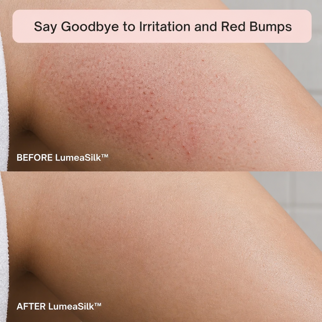 LumeaSilk™ — Trim the Bikini Line Free from Cuts, Burns, or Ingrown Hairs