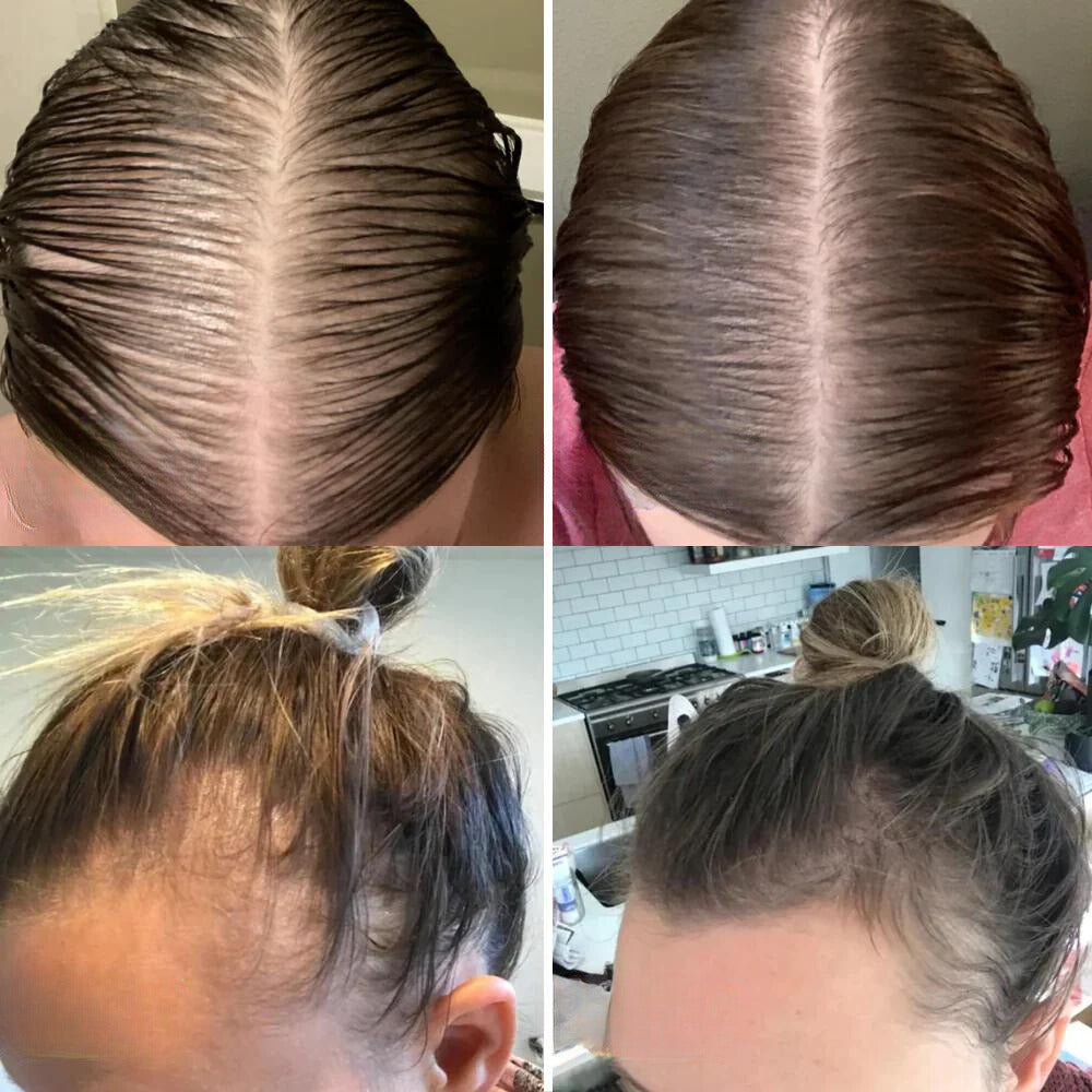 RevitaSilk™ — Unlock Lush, Thick Hair That Commands Attention and Confidence