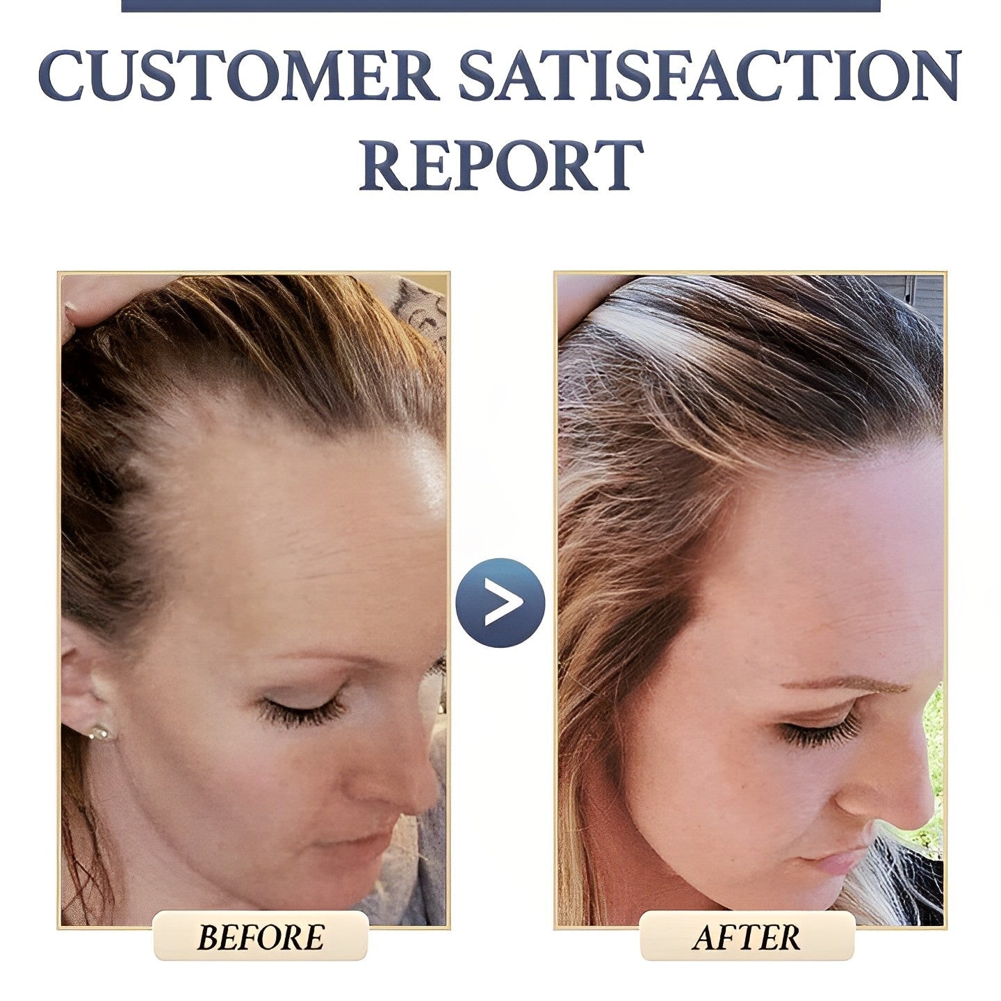Buy One Get One Free Today | Anti-Hair Loss Rice Shampoo Bar