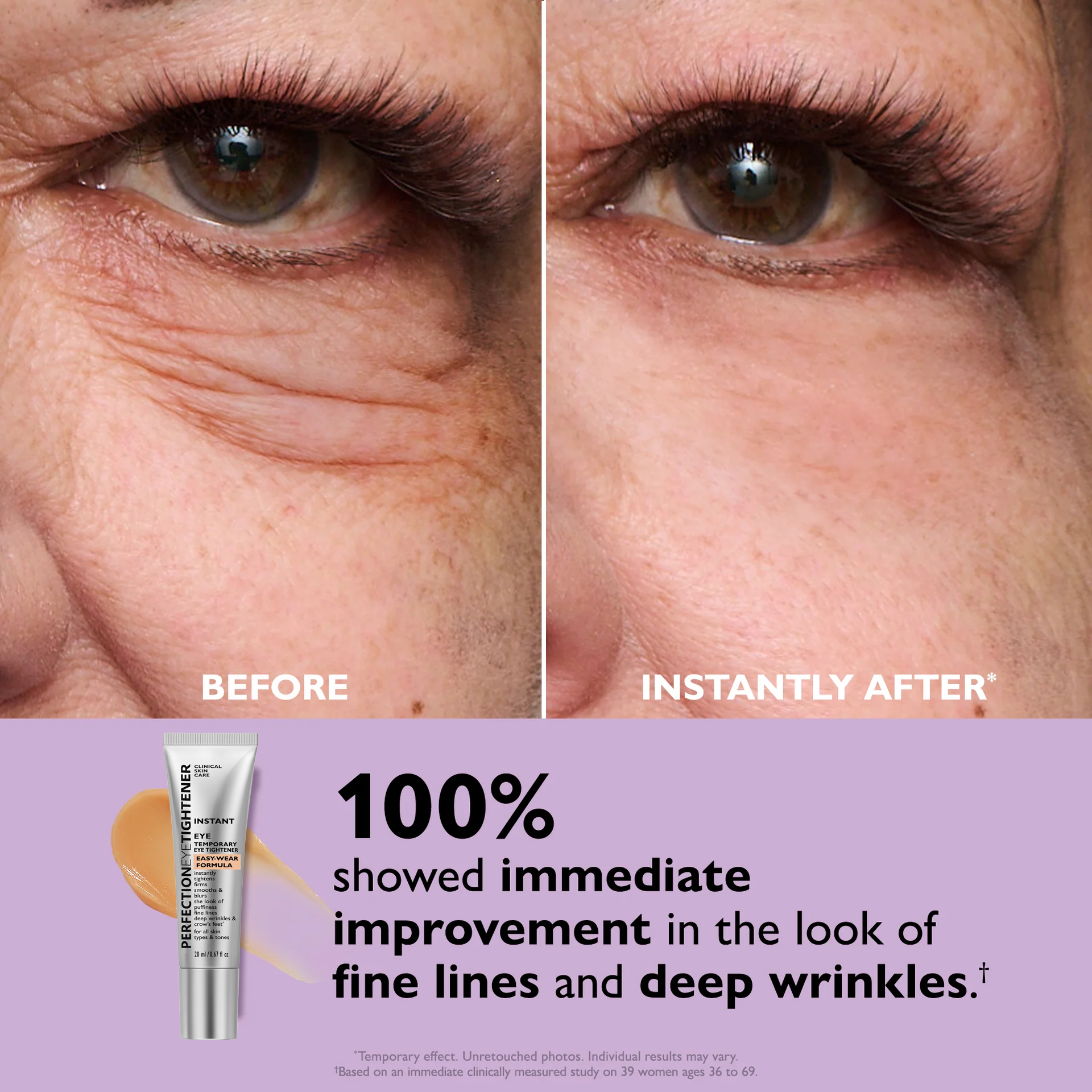 VivaLuxe™ — Wake Up to Youthful, Radiant Eyes Instantly