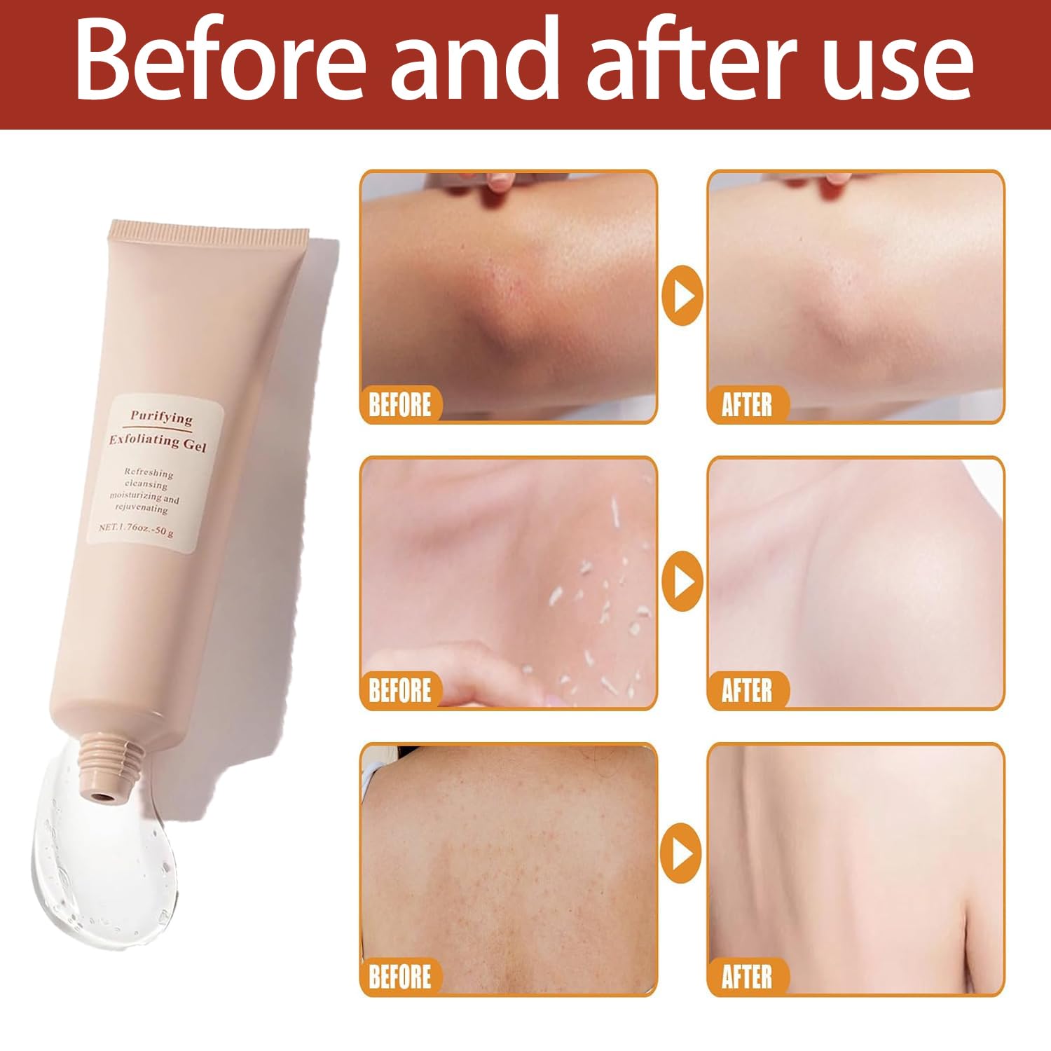 RadianceRush™ Exfoliating Gel — Reveal Touchably Soft, Brilliant Skin in Just One Minute