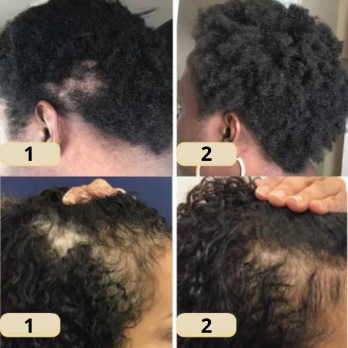 RevitaSilk™ — Unlock Lush, Thick Hair That Commands Attention and Confidence