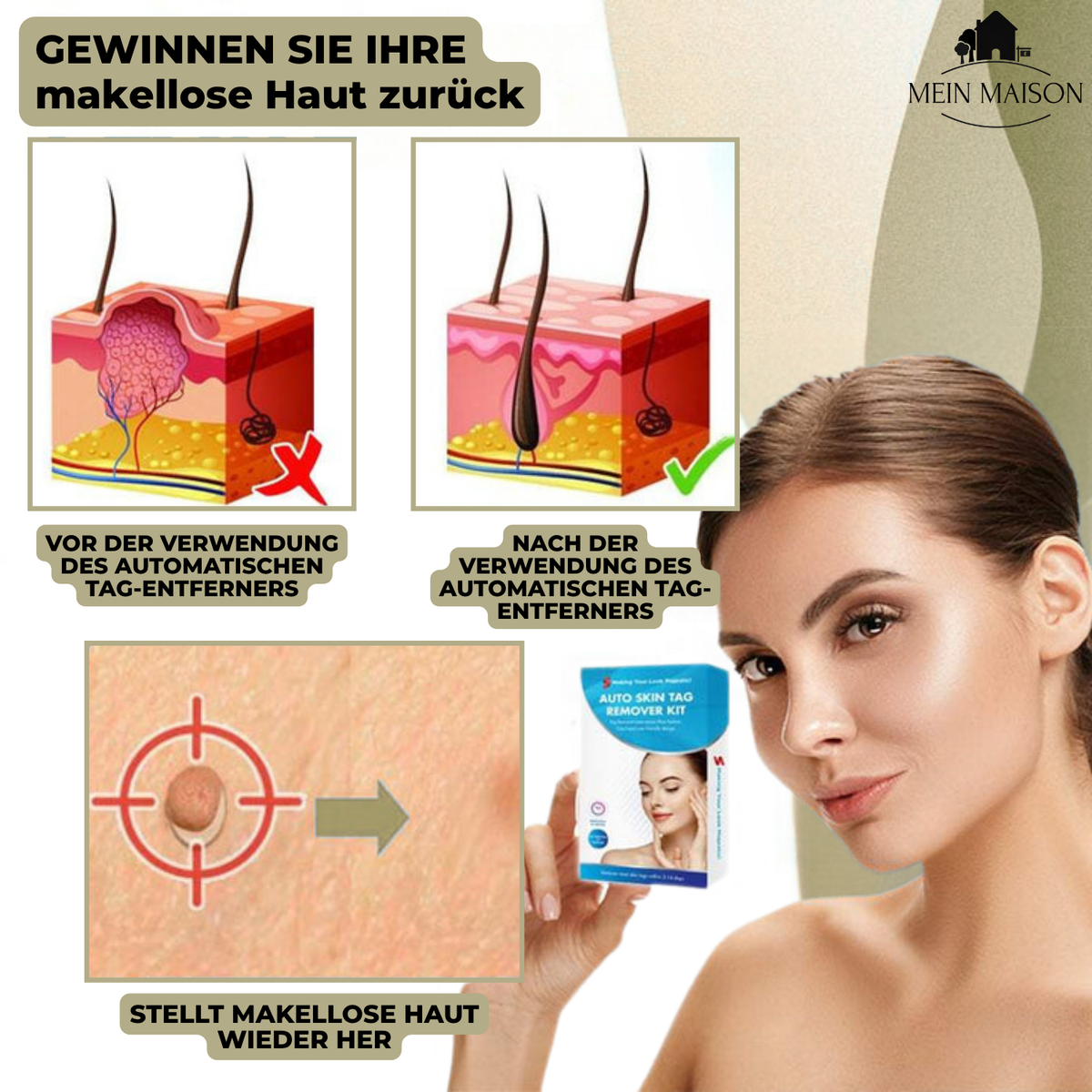 Skin Treatment for Wart and Mole Removal at Home Without Pain