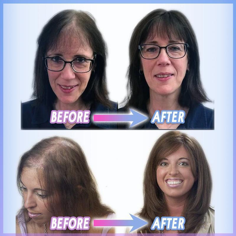 SilkShade™ Hair Clip — Instantly Thicker, Youthful Hair That Stays Perfect All Day