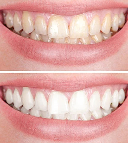 BrilluraGlow™ — Unleash a Radiant Smile That Commands Confidence Instantly