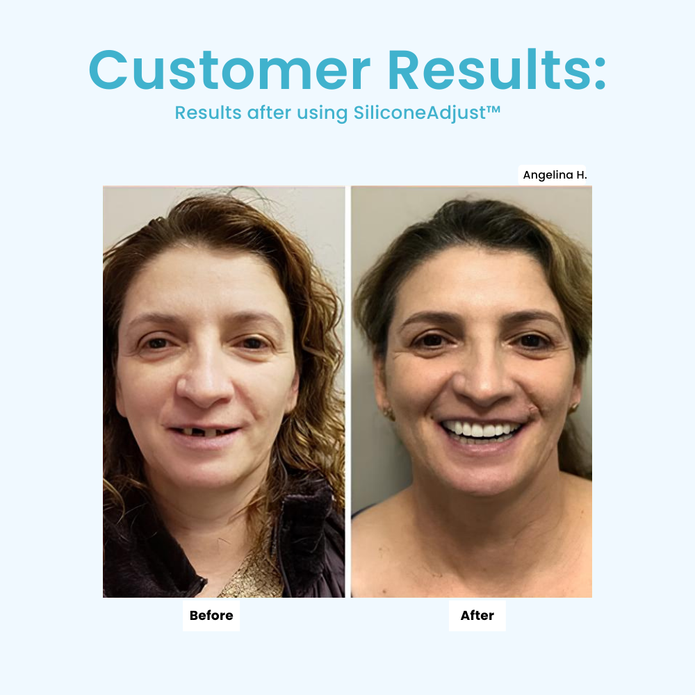 FlexiFitPro™ — Experience All-Day Denture Comfort That Feels Like You