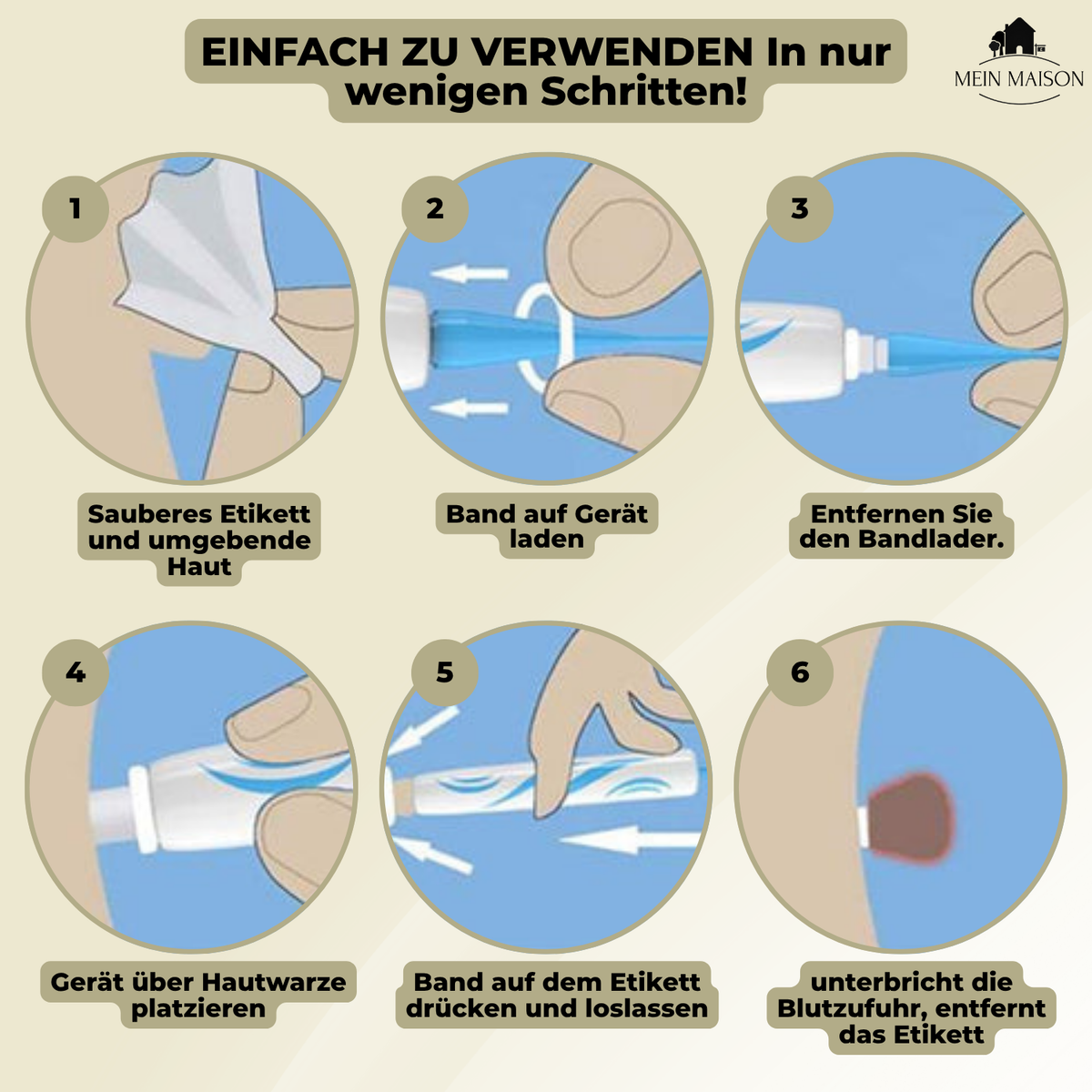 Skin Treatment for Wart and Mole Removal at Home Without Pain