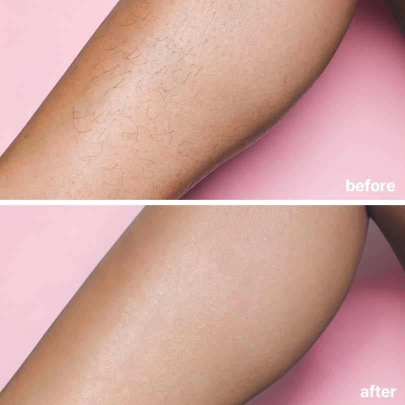 BareBasic™ No-Shave Hair Removal Cream — Smooth, Silky Skin in Minutes Without the Pain or Irritation
