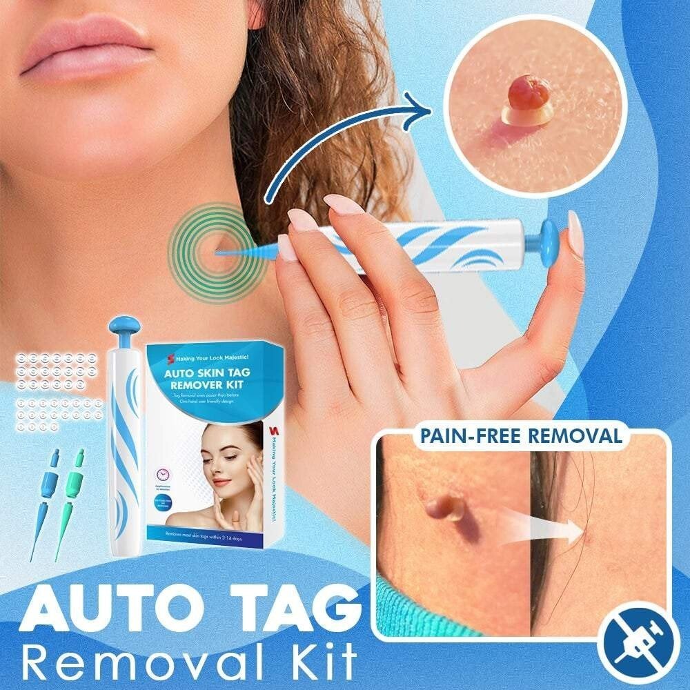 CircuLuxe™ — Pain-Free Skin Tag Removal for Instant Confidence and Clear, Radiant Skin