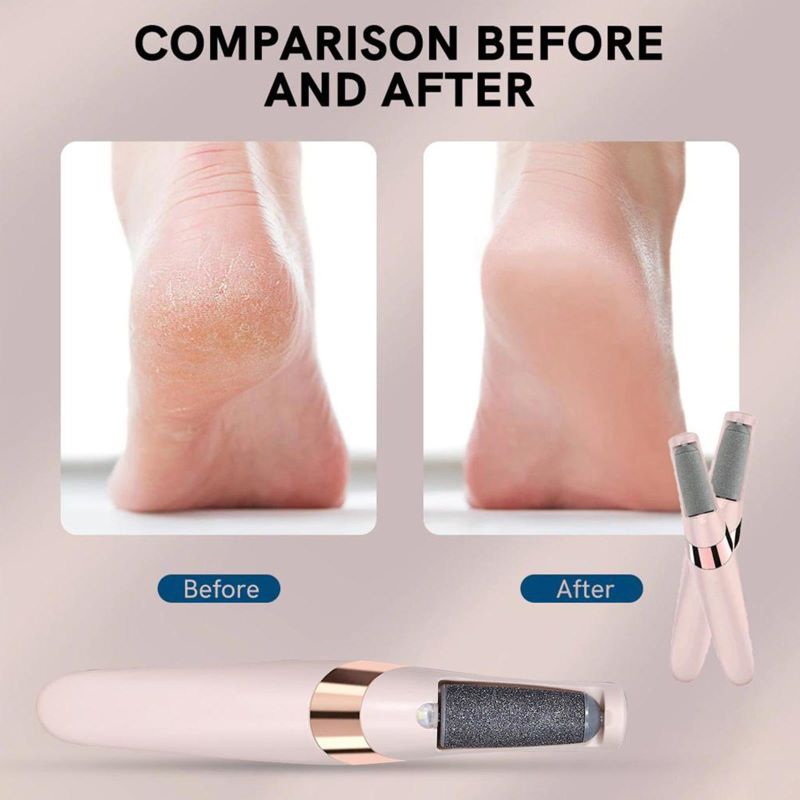 Foot Care Device for Smoother Skin – Electric Callus Remover