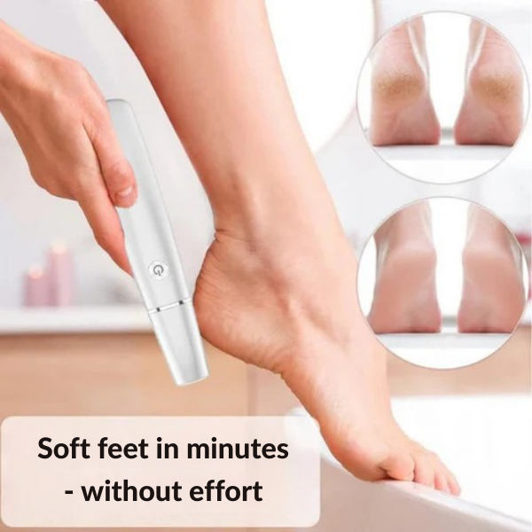 InstantSilk™ — Unlock Baby-Soft Feet That Own Every Step