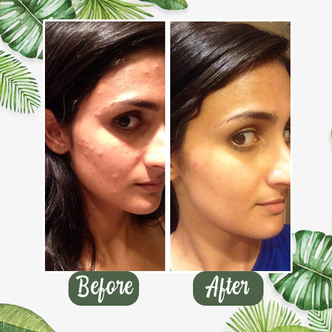 ClearVera™ — Unlock Deep Detox for Silky, Shine-Free Skin You’ll Love to Touch