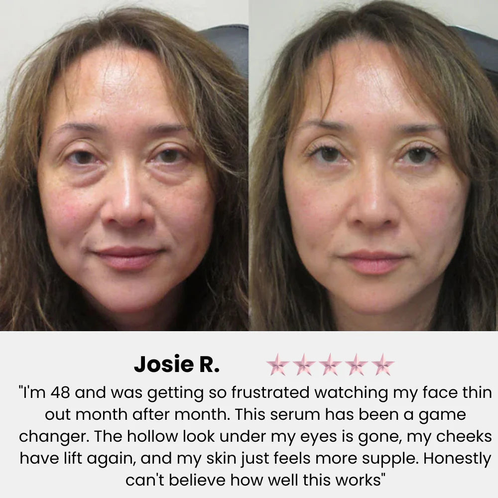Instant Skin Lift for Youthful, Plump Appearance - Radiate Confidence