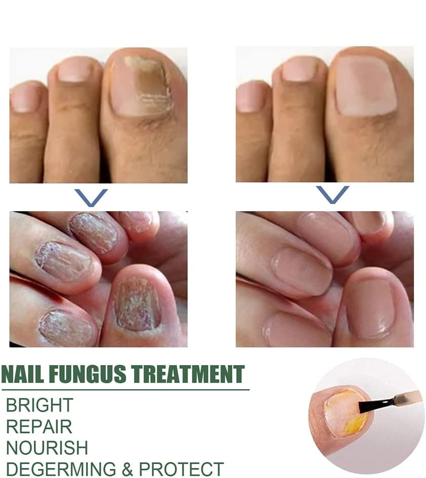 ClearStep™ — Step Confidently with Clear, Strong Nails That Demand Attention