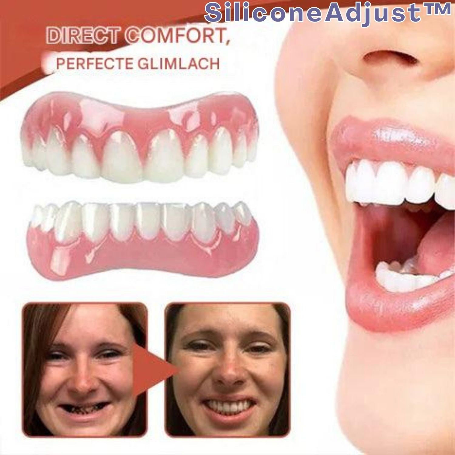 SilkFit™ Denture Comfort Kit — Experience Pain-Free, Perfectly Fitted Dentures That Feel Like Yours