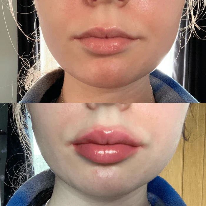 Hydrating Lip Gloss for Volume - Instant Lip Plumper Serum