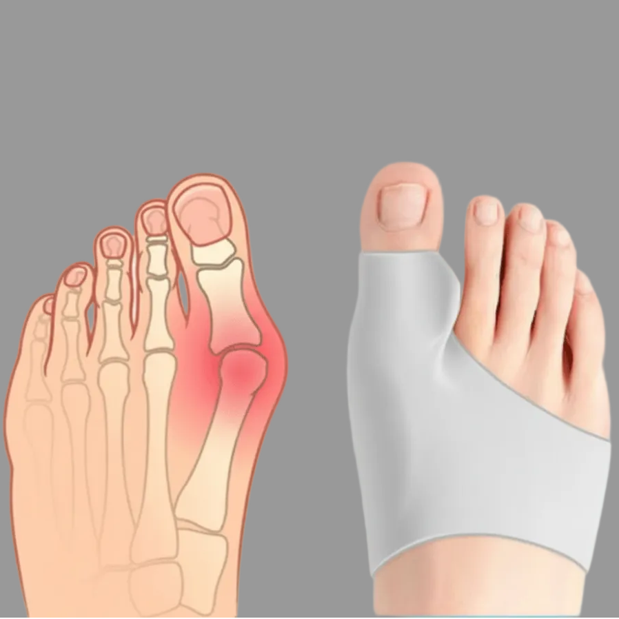 Hallux Valgus Support Brace for Daily Comfort and Correction