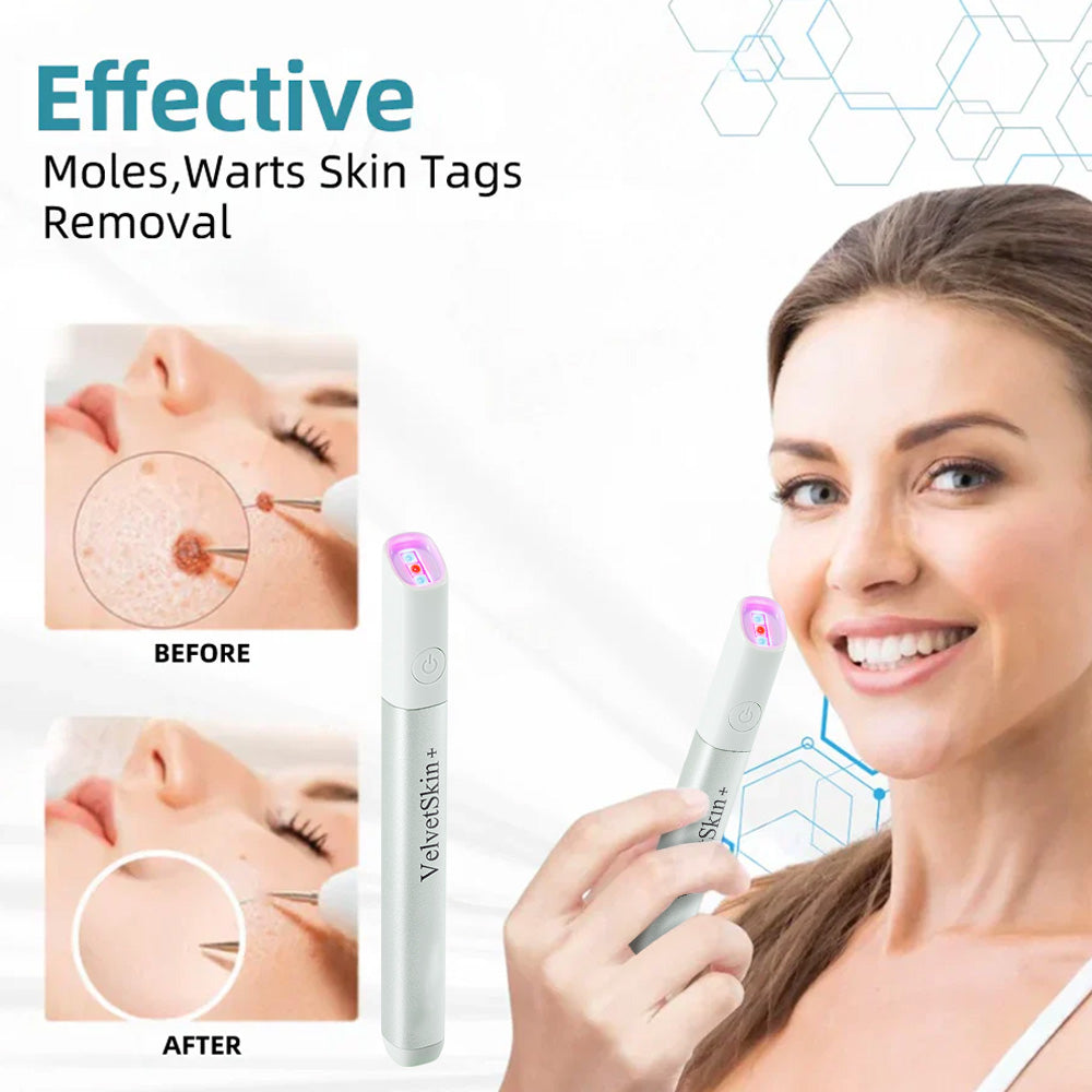 CO₂ Technology Laser Pen for Treating Skin Imperfections