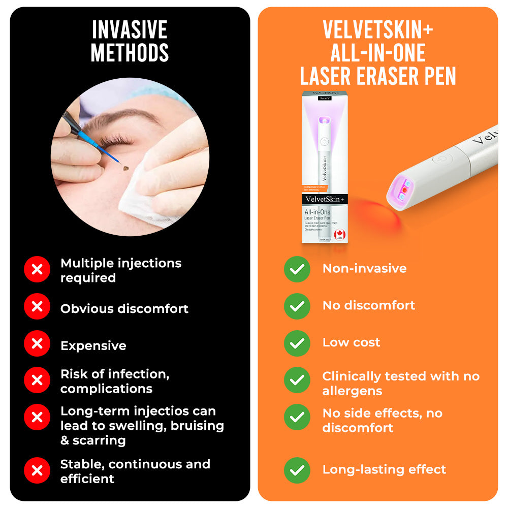 CO₂ Technology Laser Pen for Treating Skin Imperfections
