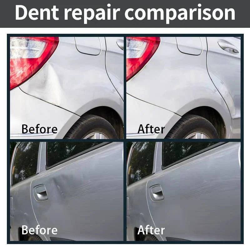 Dent Repair Kit Paintless Steel & Plastic