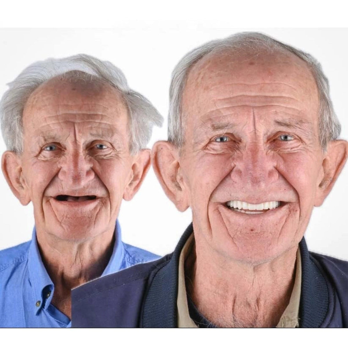Denture Set Full Arch Flexible Cushion Grip