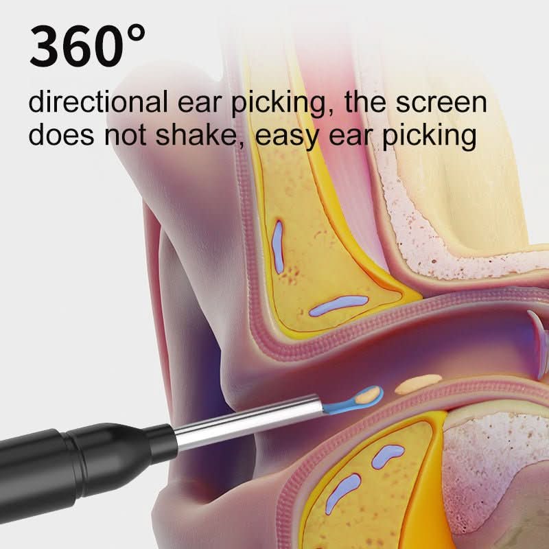 Ear Inspection Camera HD Imaging 6 LED Lights
