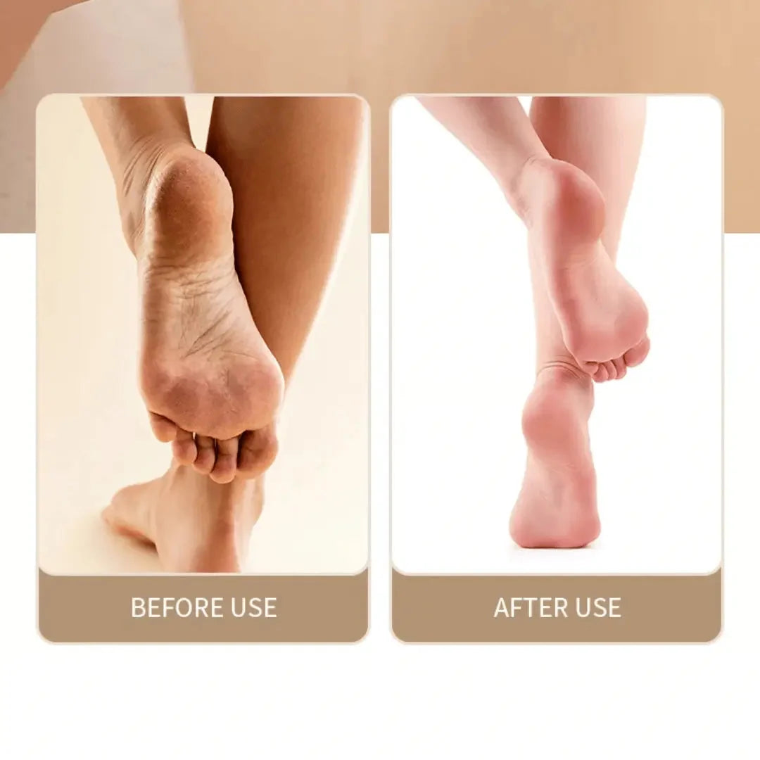 Electric Foot File Rechargeable Cordless High-Speed Rotating Head