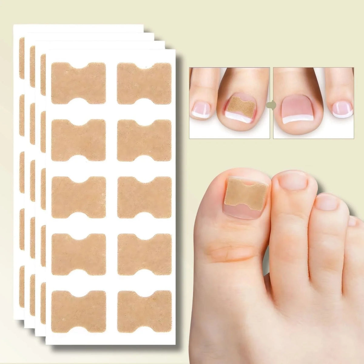 Nail Correction Patches Elastic Fabric Peel-and-Stick 20 Count