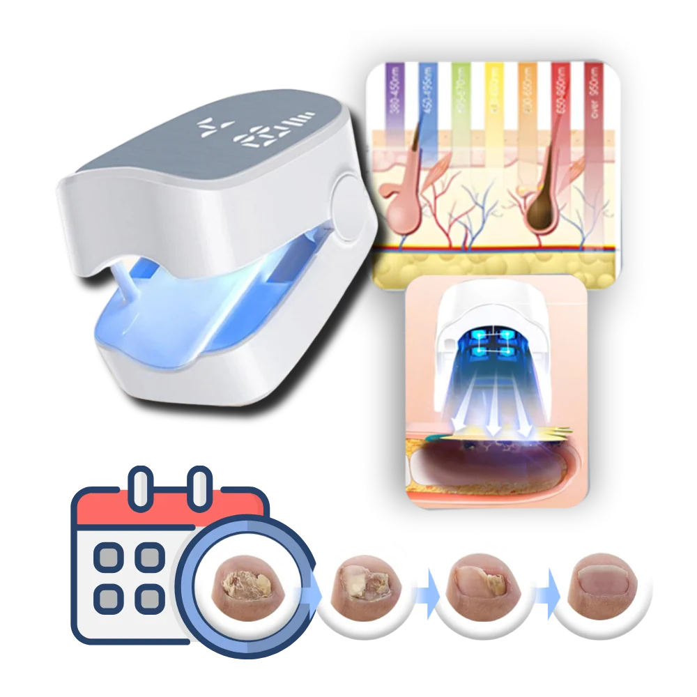 Nail Laser Device Dual Cold Laser & Blue Light