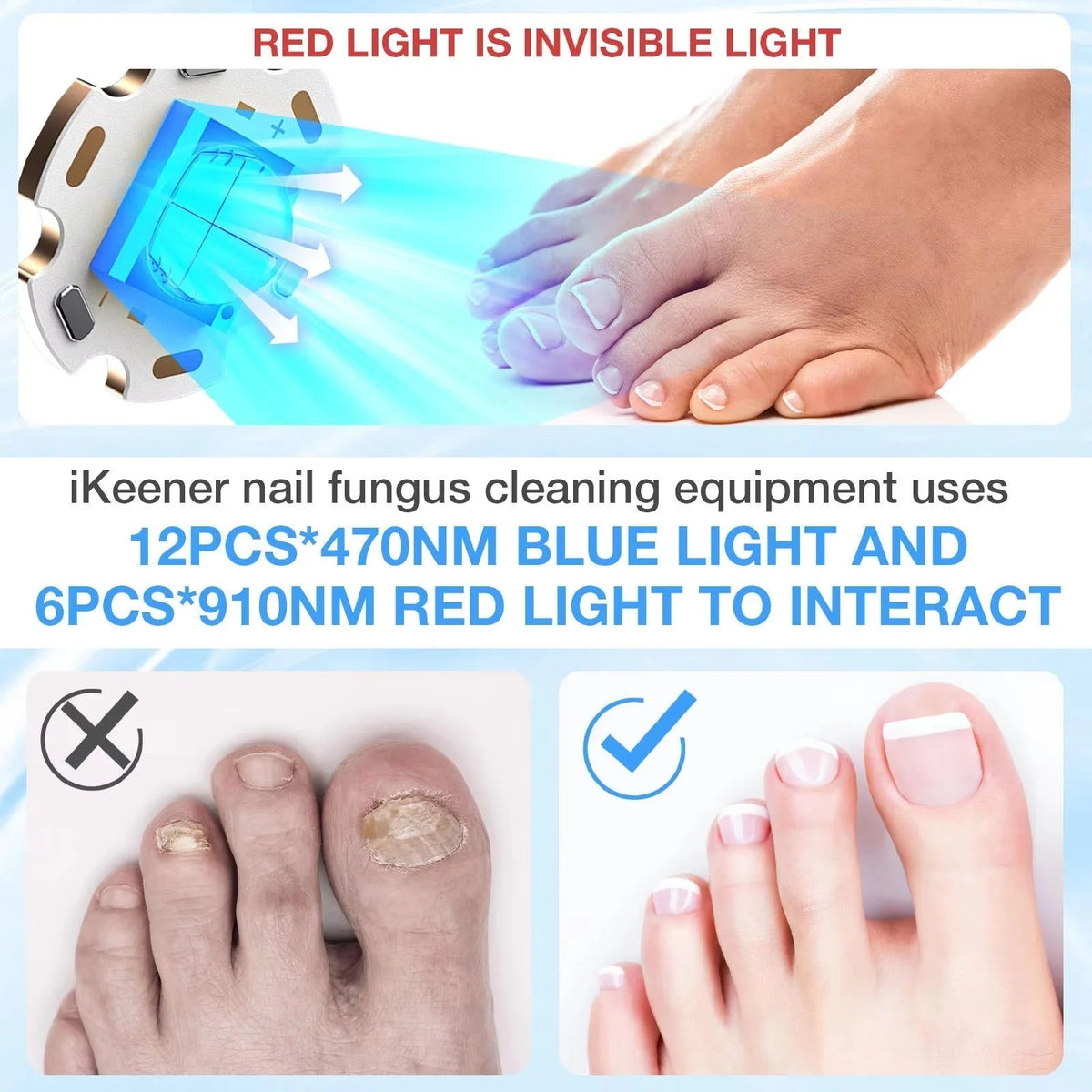 Nail Therapy Device Dual-Wavelength Light Automatic Sensor