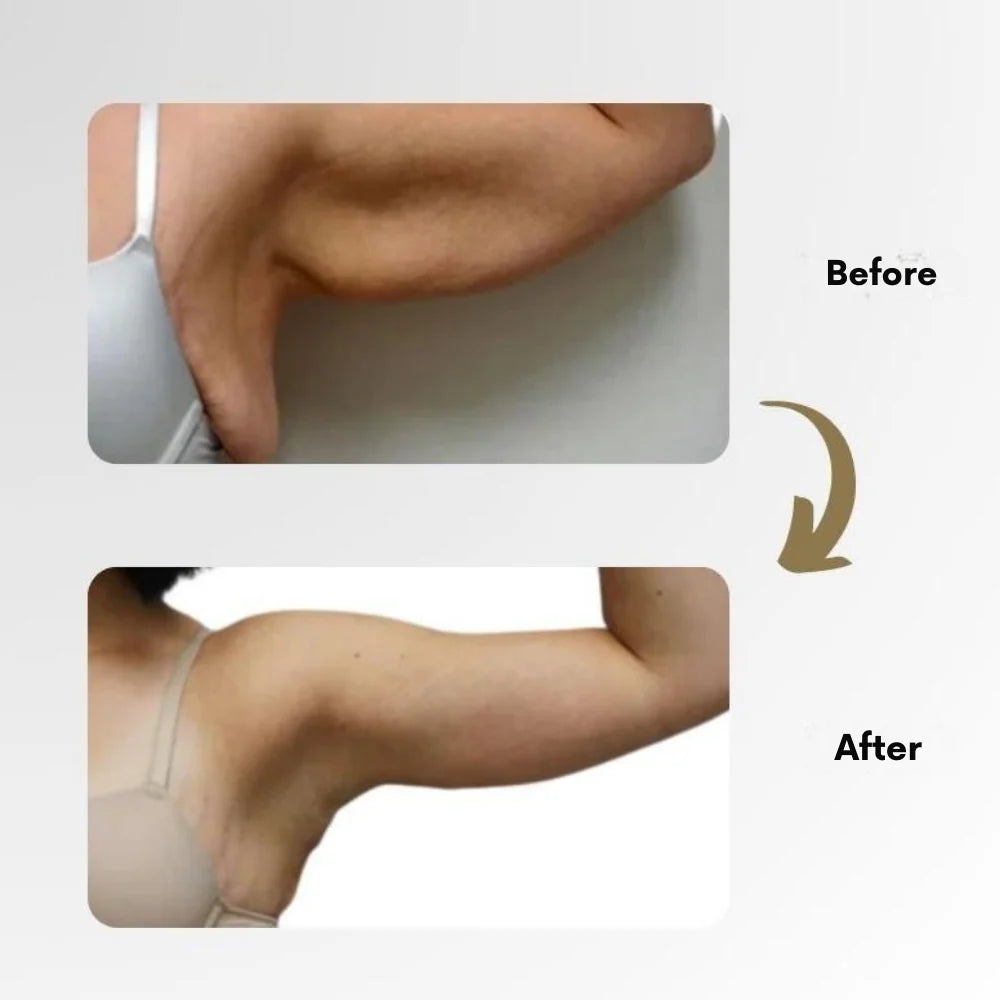Ring Magnetic Ion Therapy