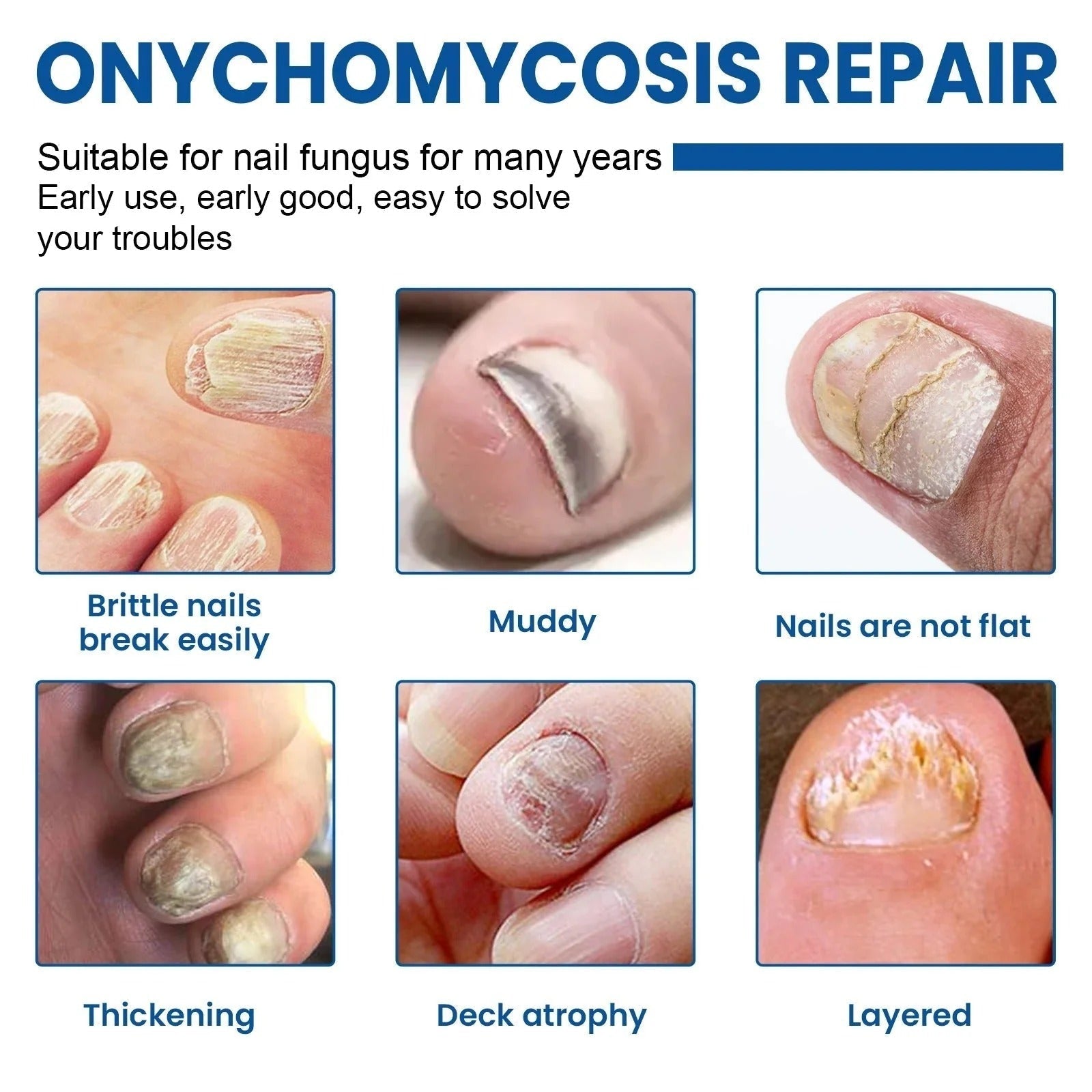 Nail Fungus Treatment Patch | Overnight Care | Regenerating Formula