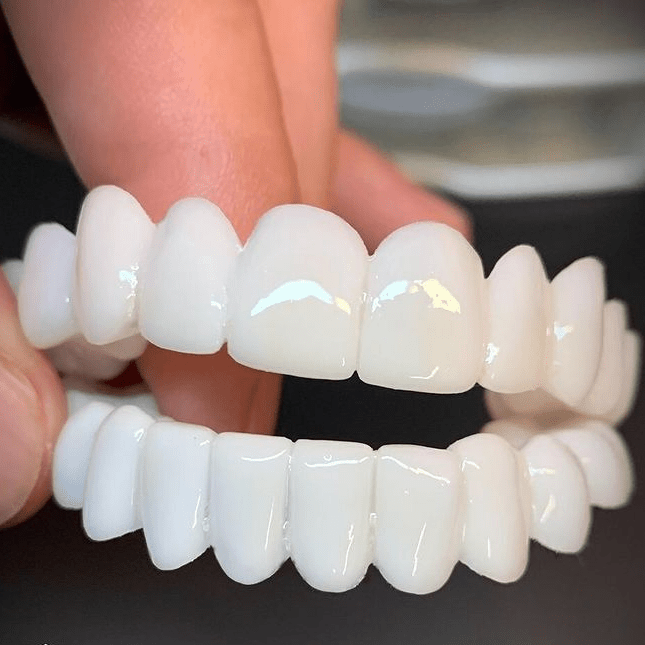 Retro-Inspired Dental Grillz for Bold Smiles