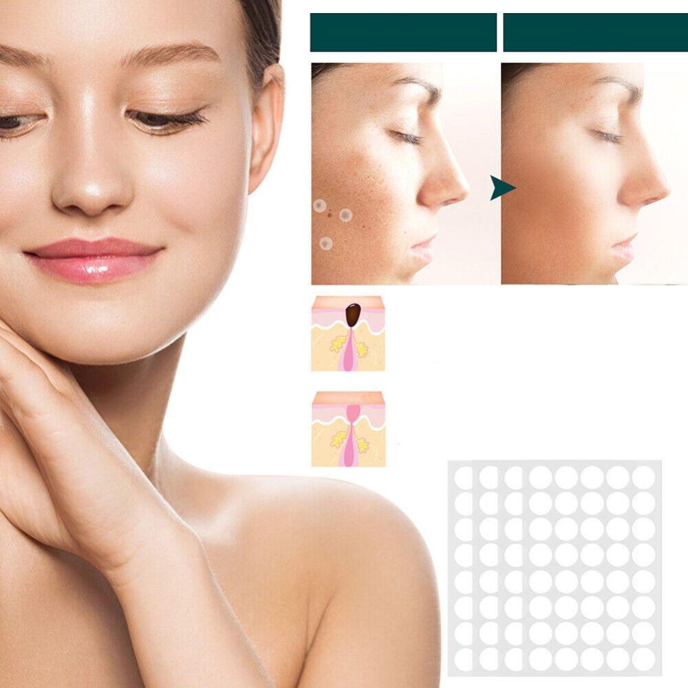 Skin Treatment Patches for Spot and Wart Removal – Discreet Design
