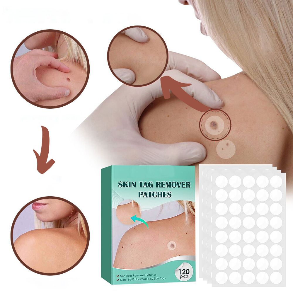 Skin Treatment Patches for Spot and Wart Removal – Discreet Design