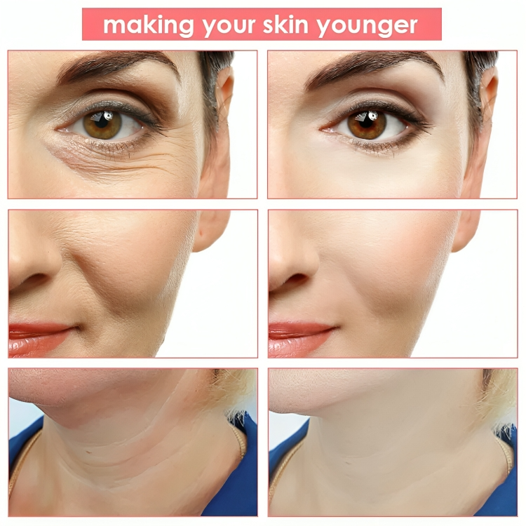 Facial Massage for Skin Tightening β ToneLift Device