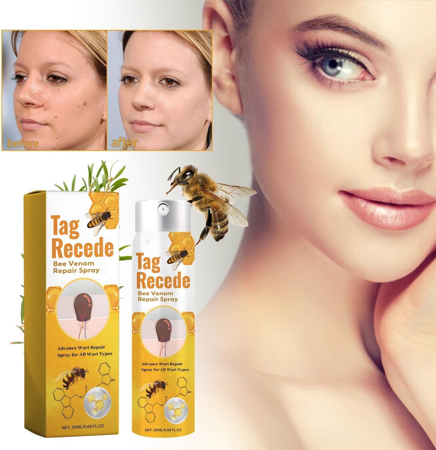 Wart Remover | Targeted Skin Spray | Bee Venom Care Formula