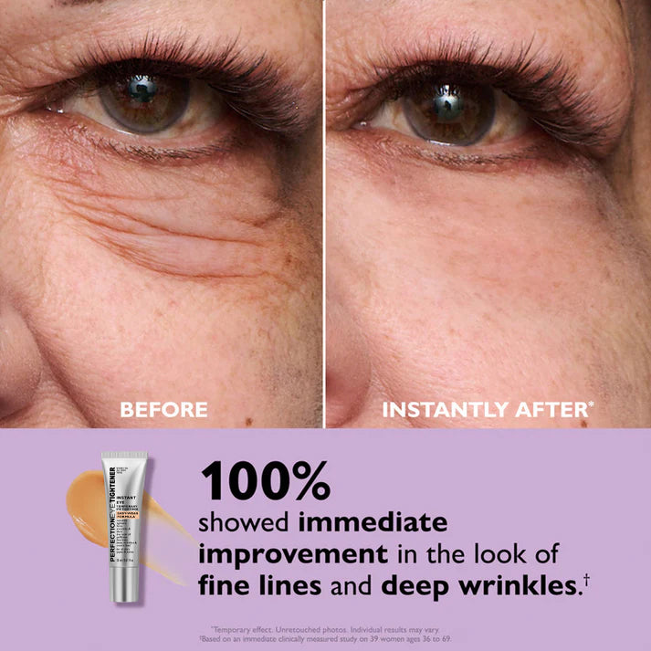 VivaTense™ — Instant Eye Lift for Radiant, Youthful Confidence That Lasts All Day