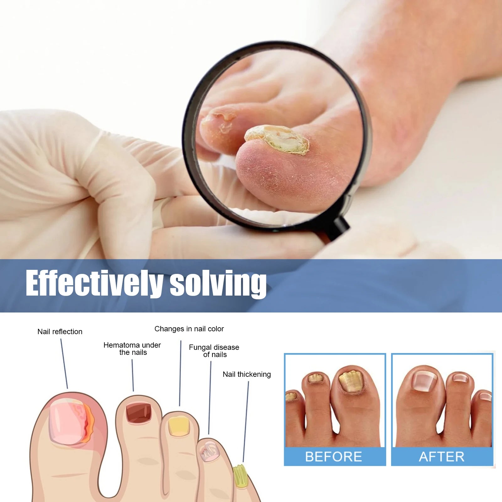 VitalDerm™ — Reveal Strong, Clean Nails That Boost Your Confidence Instantly