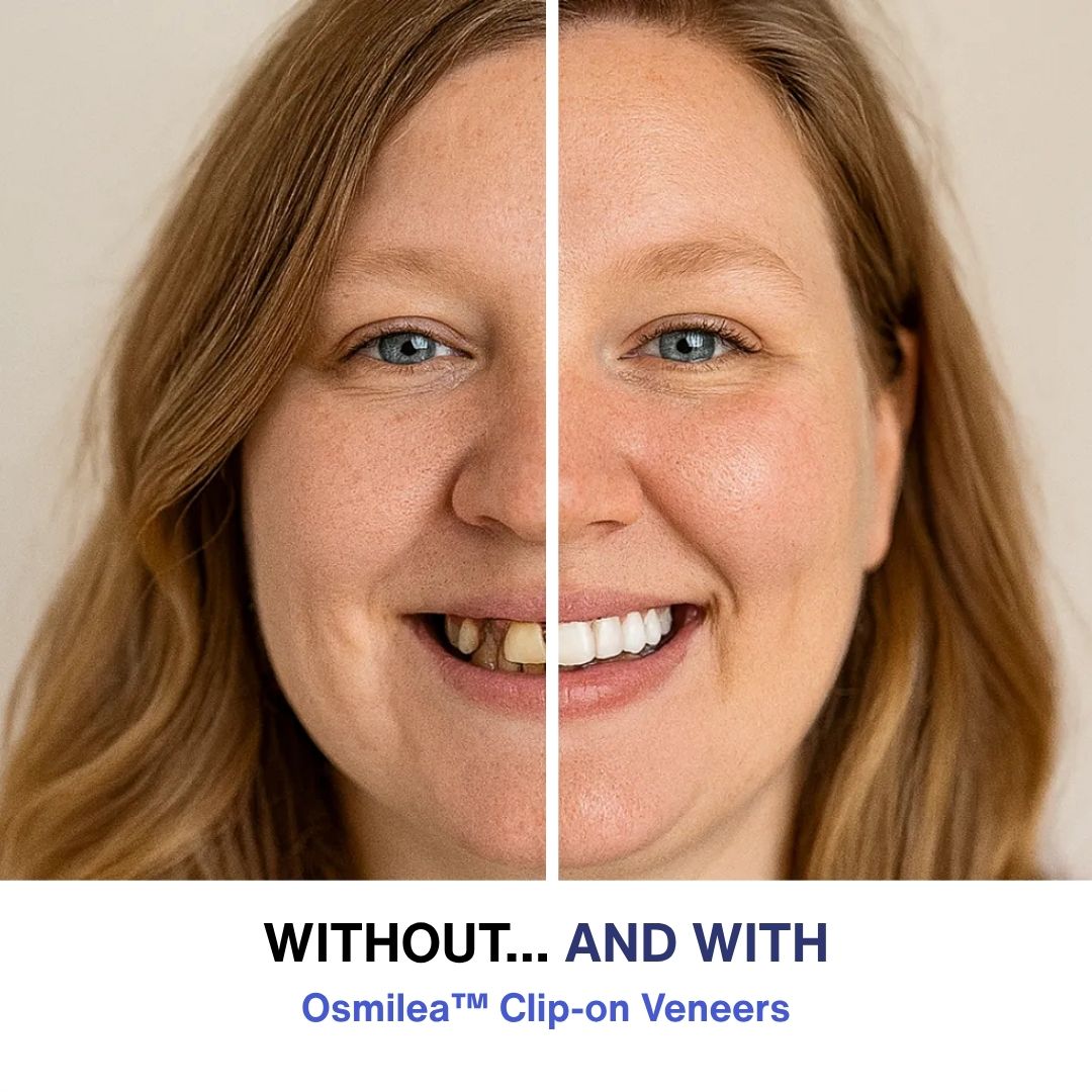 SmileLux™ — Instantly Own a Dazzling, Camera-Ready Smile Anywhere