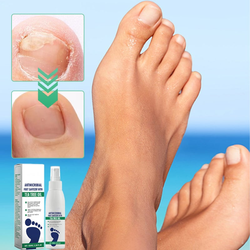 Tea Tree Oil Foot Spray with Antimicrobial Properties