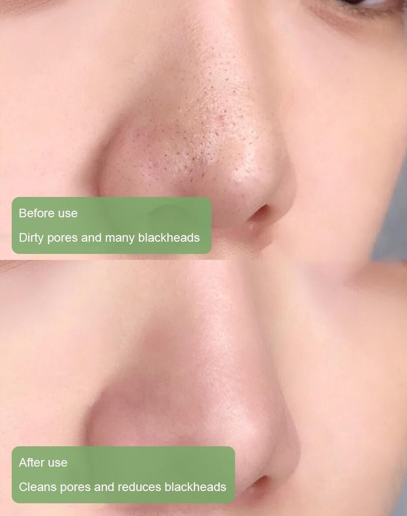 ClearVera™ — Unlock Deep Detox for Silky, Shine-Free Skin You’ll Love to Touch