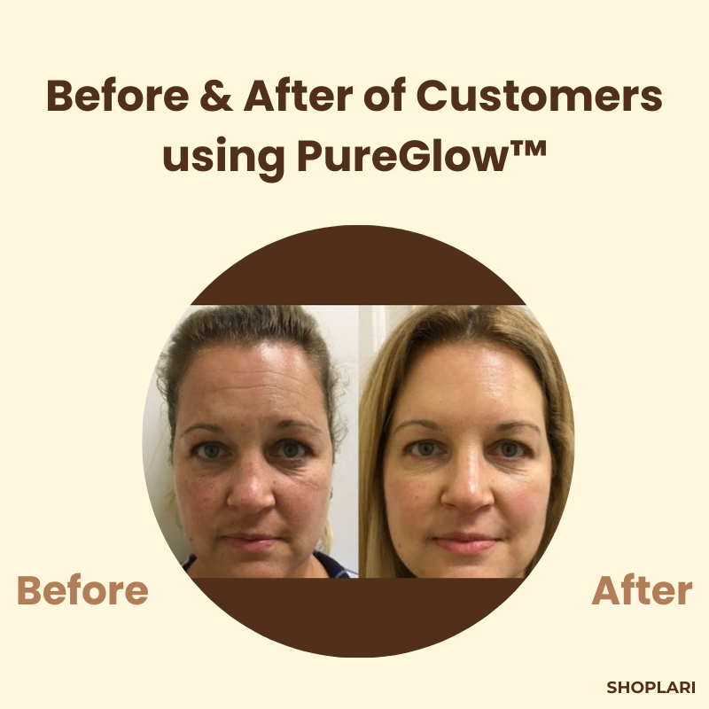 RamonaFlex™ — Unlock Radiant, Youthful Skin That Commands Attention