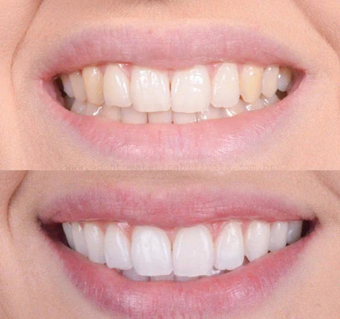 BrilluraGlow™ — Unleash a Radiant Smile That Commands Confidence Instantly