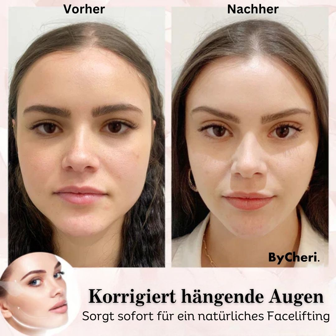 Buy One Get One Free Today | 2025 Invisible Face Lifting Band Set
