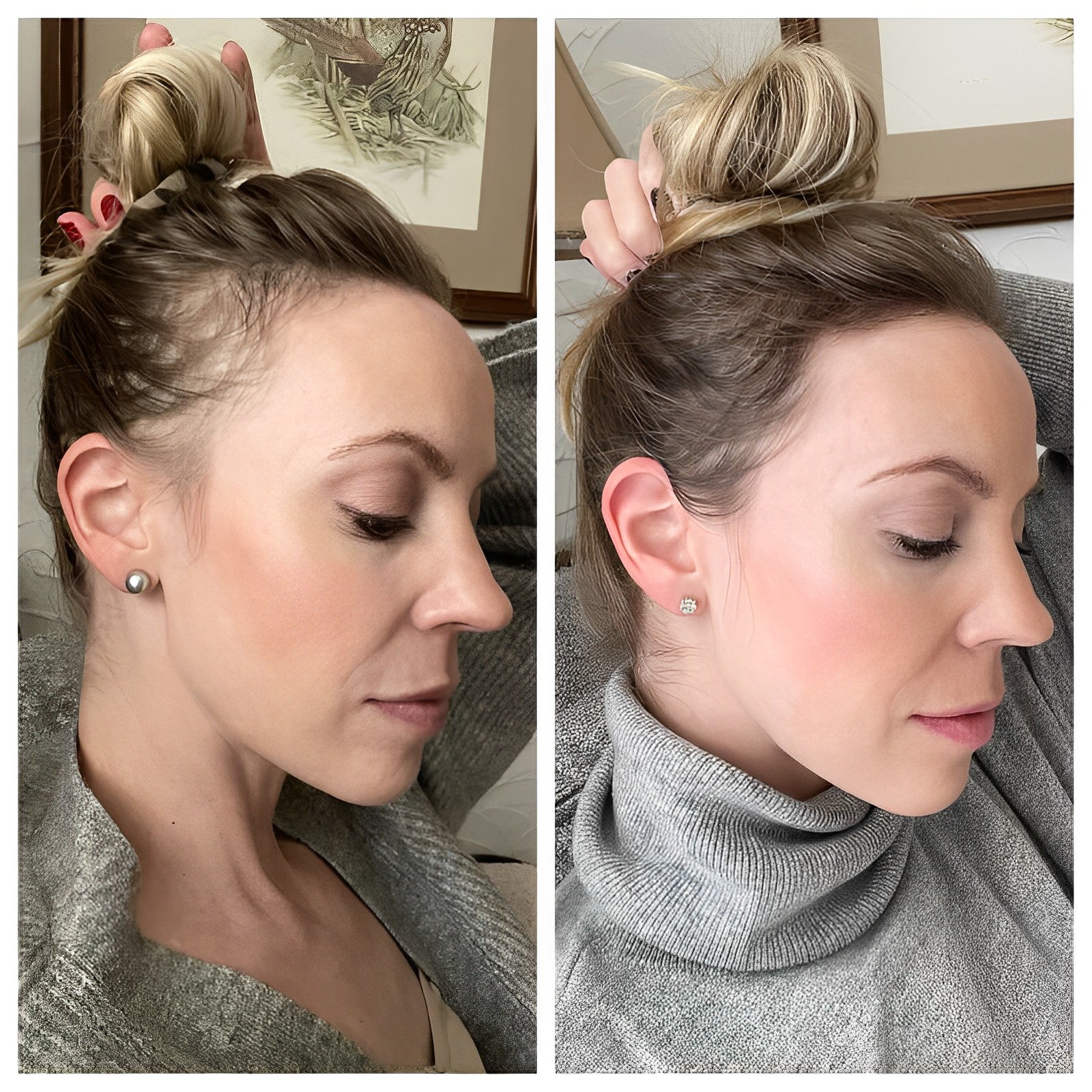 Buy One Get One Free Today | Anti-Hair Loss Rice Shampoo Bar