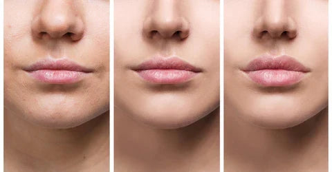 Hydrating Lip Gloss for Volume - Instant Lip Plumper Serum