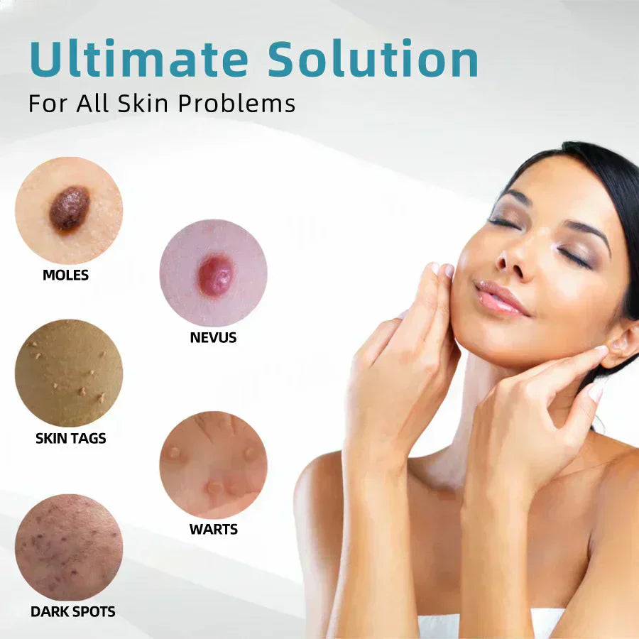 CO₂ Technology Laser Pen for Treating Skin Imperfections